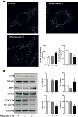 Mifepristone for Treatment of Metabolic Syndrome: Beyond Cushing’s Syndrome